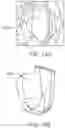 Fig. 29 - DEVICES, SYSTEMS, AND METHODS FOR MAINTAINING A STERILE SURGICAL FIELD