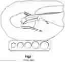 Fig. 02 - Surgical instrument handle with implant sizing feature and method of using