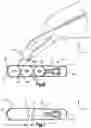 Fig. 06 - Surgical instrument handle with implant sizing feature and method of using