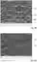 Fig. 04 - DENTAL DRILL SURFACE TREATMENT