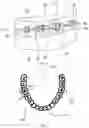 Fig. 05 - Orthodontic device