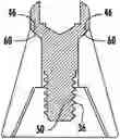 Fig. 01 - Dental abutment screw