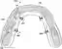 Fig. 01 - Dental prosthetic assemblies and coupling systems