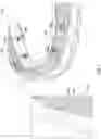 Fig. 02 - Dental prosthetic assemblies and coupling systems