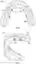 Fig. 06 - Dental prosthetic assemblies and coupling systems