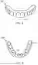 Fig. 02 - Dental devices and systems and methods for making the same