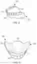 Fig. 10 - Dental devices and systems and methods for making the same