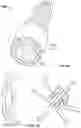 Fig. 25 - SPACE FILLING DEVICES