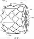 Fig. 50 - SPACE FILLING DEVICES