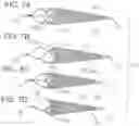 Fig. 06 - Embolic protection device