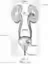 Fig. 03 - URETERAL STENT AND RETRIEVAL MEANS