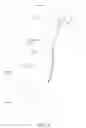 Fig. 05 - URETERAL STENT AND RETRIEVAL MEANS
