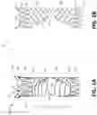 Fig. 02 - FLOW RESTRICTING STENT-GRAFT
