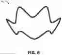 Fig. 09 - FLOW RESTRICTING STENT-GRAFT