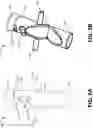 Fig. 12 - FLOW RESTRICTING STENT-GRAFT