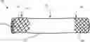 Fig. 01 - APPARATUS AND METHOD FOR FLUID FLOW THROUGH BODY PASSAGES