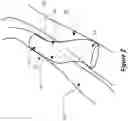Fig. 03 - APPARATUS AND METHOD FOR FLUID FLOW THROUGH BODY PASSAGES