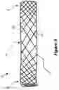 Fig. 04 - APPARATUS AND METHOD FOR FLUID FLOW THROUGH BODY PASSAGES