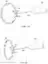 Fig. 03 - FLUID-FILLED HAPTIC FOR AN INTRAOCULAR LENS