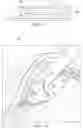 Fig. 04 - FLUID-FILLED HAPTIC FOR AN INTRAOCULAR LENS