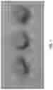 Fig. 08 - SHAPE MEMORY POLYMER FOAMS TO SEAL SPACE AROUND VALVES