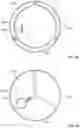 Fig. 07 - Passive alignment of commissures in prosthetic heart valve implantation