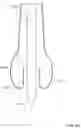 Fig. 10 - Passive alignment of commissures in prosthetic heart valve implantation