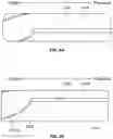 Fig. 05 - Active alignment of commissures in prosthetic heart valve implantation