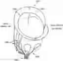 Fig. 01 - DEVICES, SYSTEMS AND METHODS FOR REPAIRING LUMENAL SYSTEMS