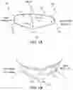Fig. 02 - DEVICES, SYSTEMS AND METHODS FOR REPAIRING LUMENAL SYSTEMS