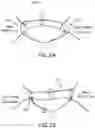 Fig. 03 - DEVICES, SYSTEMS AND METHODS FOR REPAIRING LUMENAL SYSTEMS