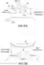 Fig. 04 - DEVICES, SYSTEMS AND METHODS FOR REPAIRING LUMENAL SYSTEMS
