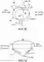 Fig. 05 - DEVICES, SYSTEMS AND METHODS FOR REPAIRING LUMENAL SYSTEMS