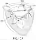 Fig. 16 - DEVICES, SYSTEMS AND METHODS FOR REPAIRING LUMENAL SYSTEMS