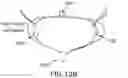 Fig. 21 - DEVICES, SYSTEMS AND METHODS FOR REPAIRING LUMENAL SYSTEMS