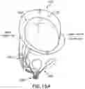 Fig. 26 - DEVICES, SYSTEMS AND METHODS FOR REPAIRING LUMENAL SYSTEMS
