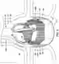 Fig. 03 - AORTIC VALVE REPLACEMENT