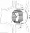 Fig. 05 - AORTIC VALVE REPLACEMENT