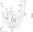 Fig. 07 - AORTIC VALVE REPLACEMENT