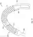 Fig. 18 - AORTIC VALVE REPLACEMENT