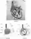 Fig. 06 - APPARATUS AND METHODS FOR TREATING A DEFECTIVE CARDIAC VALVE