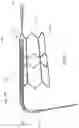 Fig. 07 - APPARATUS AND METHODS FOR TREATING A DEFECTIVE CARDIAC VALVE