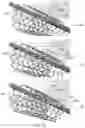 Fig. 12 - APPARATUS AND METHODS FOR TREATING A DEFECTIVE CARDIAC VALVE