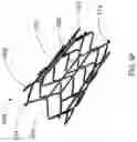 Fig. 13 - APPARATUS AND METHODS FOR TREATING A DEFECTIVE CARDIAC VALVE