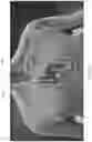 Fig. 29 - APPARATUS AND METHODS FOR TREATING A DEFECTIVE CARDIAC VALVE