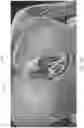 Fig. 30 - APPARATUS AND METHODS FOR TREATING A DEFECTIVE CARDIAC VALVE