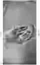 Fig. 32 - APPARATUS AND METHODS FOR TREATING A DEFECTIVE CARDIAC VALVE