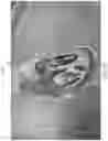 Fig. 33 - APPARATUS AND METHODS FOR TREATING A DEFECTIVE CARDIAC VALVE
