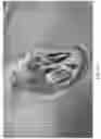 Fig. 34 - APPARATUS AND METHODS FOR TREATING A DEFECTIVE CARDIAC VALVE