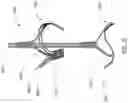 Fig. 37 - APPARATUS AND METHODS FOR TREATING A DEFECTIVE CARDIAC VALVE